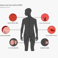 Crollano i decessi per cancro cervicale nelle giovani donne dopo l’introduzione del vaccino contro l’HPV (Papilloma Virus)