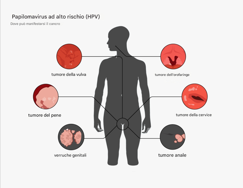 I ricercatori hanno riscontrato una riduzione della mortalità per cancro cervicale nelle donne di età inferiore ai 25 anni, probabilmente dovuta all'introduzione del vaccino contro l'HPV.