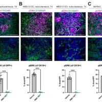 L’immunoterapia può potenziare la terapia mirata a KRAS nel cancro al pancreas