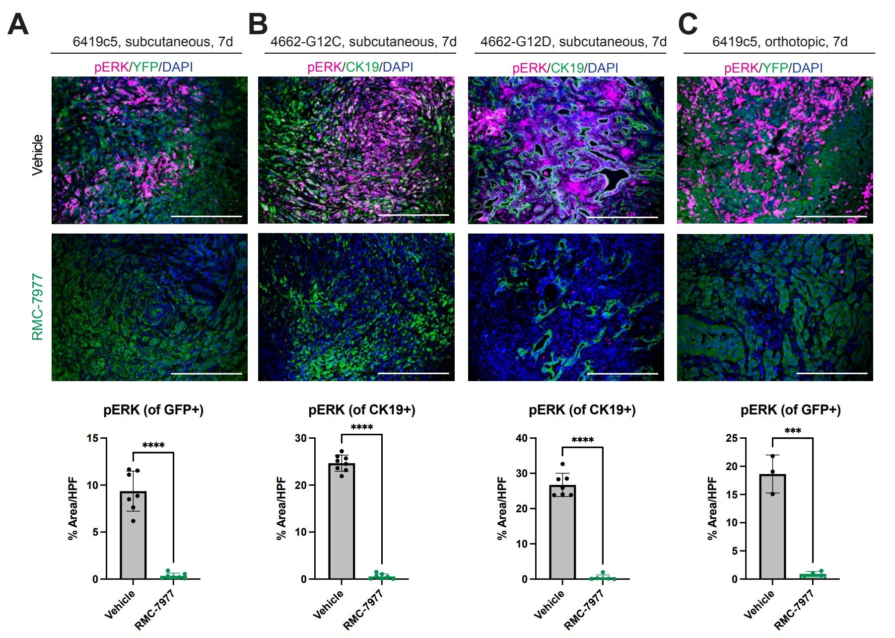 L'inibizione multiselettiva di CD-24-1475 RAS(ON) inibisce l'espressione di pERK nei tumori PDAC. dit: Cancer Discovery (2025). DOI: 10.1158/2159-8290.