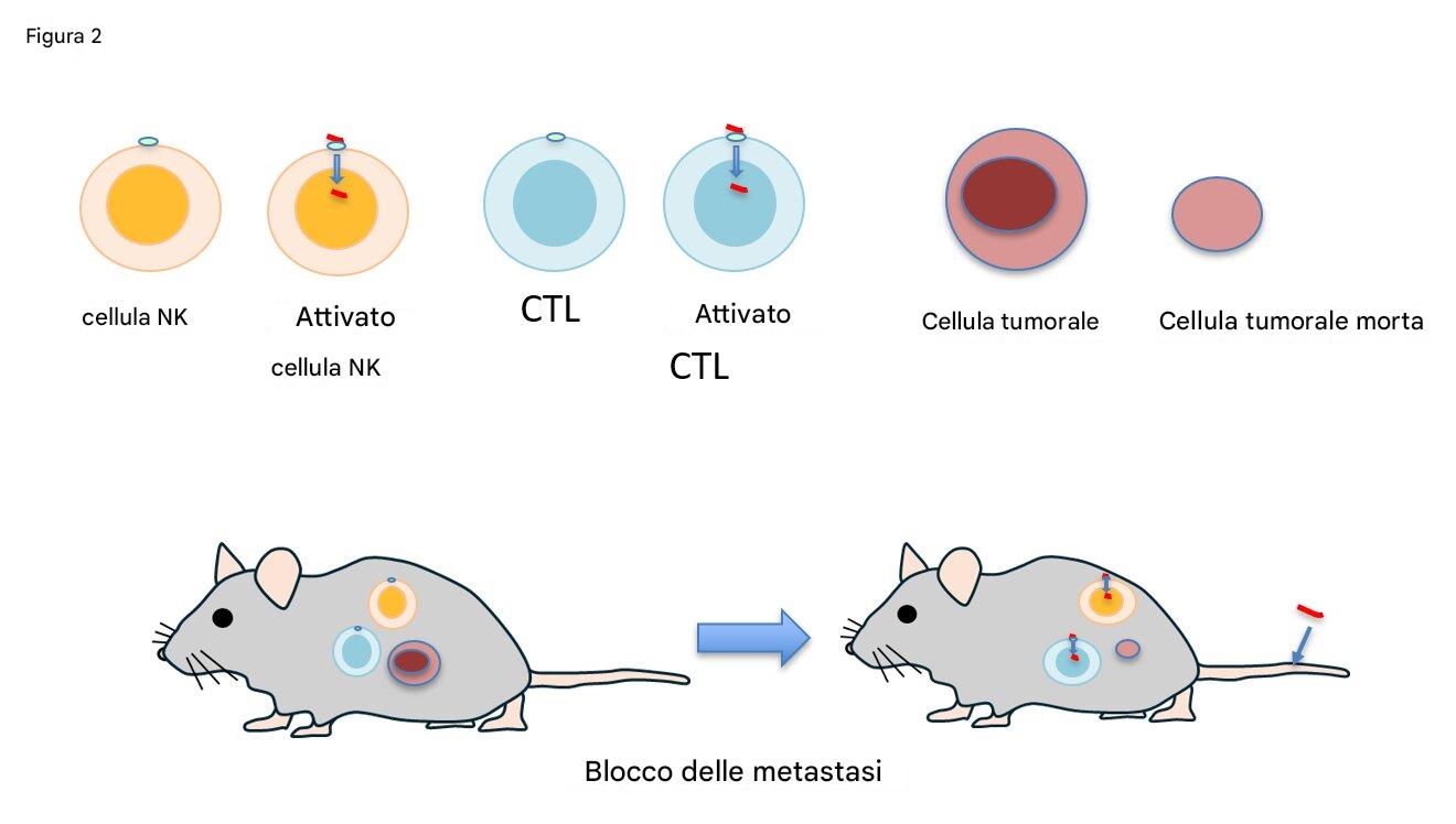 Un topo immunodeficiente che contiene cellule tumorali umane e cellule immunitarie umane dimostra metastasi tumorali nei polmoni. Tale metastasi tumorale viene prevenuta da brevi iniezioni di mRNA sintetico, poiché attivano le cellule immunitarie per uccidere le cellule tumorali. Credito: Professoressa Sachie Hiratsuka, Shinshu University School of Medicine